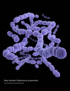 The pneumococcus (Streptococcus pneumoniae)