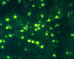 Immunofluorescent image of Haemophilus influenzae type b