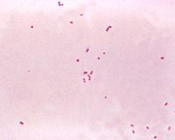 Micrograph of the meningococcus.